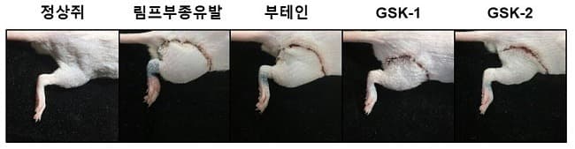 경과원 바이오센터, 난치성 질환 ‘림프부종’ 치료물질 개발 성공
