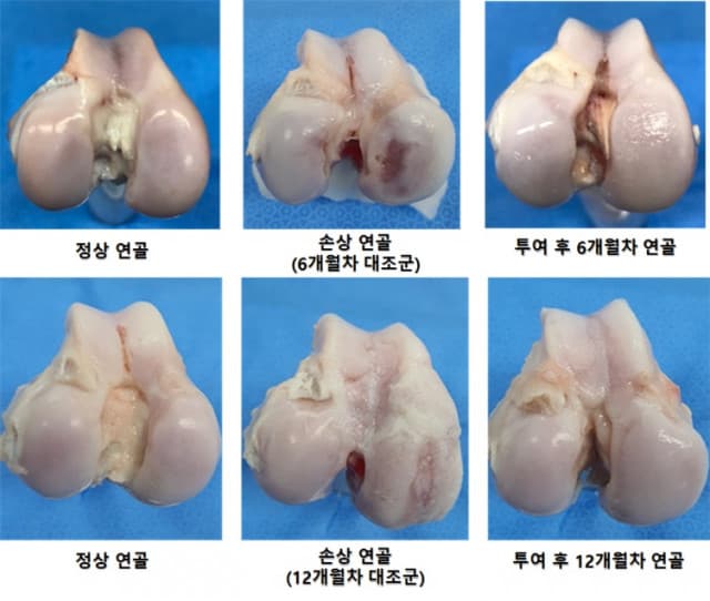 강스템바이오텍, 골관절염 치료제 임상 1/2a상 IND 승인 단회투여·연골재생 신약개발 향해 ‘성큼’